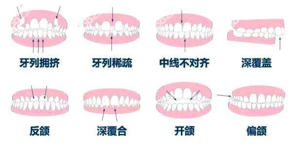 厦门麦芽口腔牙齿正畸医生