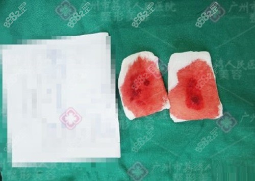 广州齐云香医生挂号电话