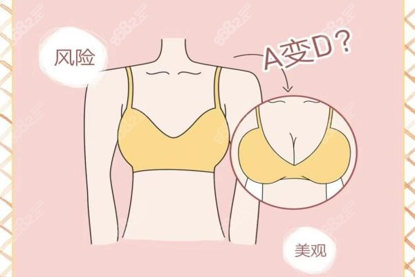 赵敬国医生隆胸怎么样了?在重庆铜雀台坐诊隆胸技术好多少钱