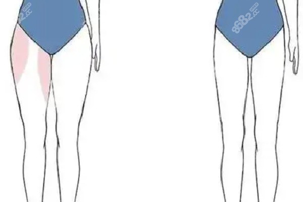 北京脂肪填充王东和王明利谁更牛价格与服务体系