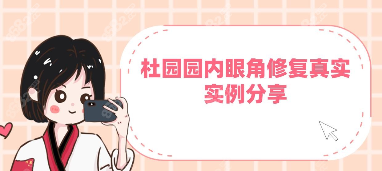 杜園園內(nèi)眼角修復(fù)真實(shí)實(shí)例分享