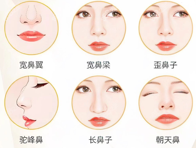 奥美定的后遗症多少年后开始显现