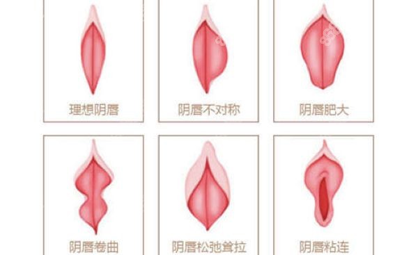  醫(yī)科大學(xué)附屬盛京醫(yī)院打緊縮針怎么樣