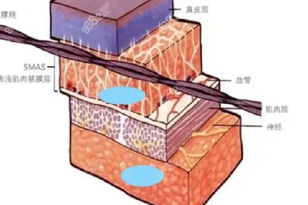 北京面部提升袁博面诊