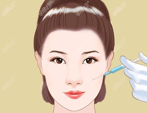 艾塑菲1个月成效