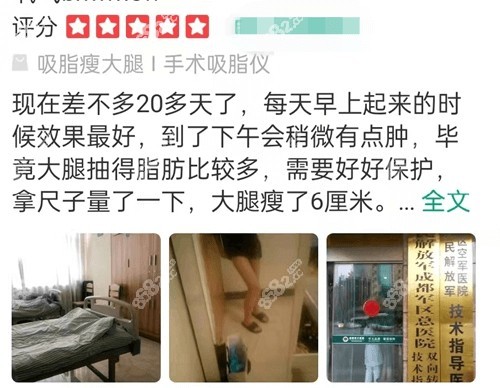 <!--<i data=20240705-sp></i>-->蒲小兵吸脂怎么样？