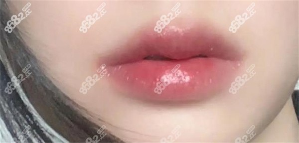 嘟嘟唇图片