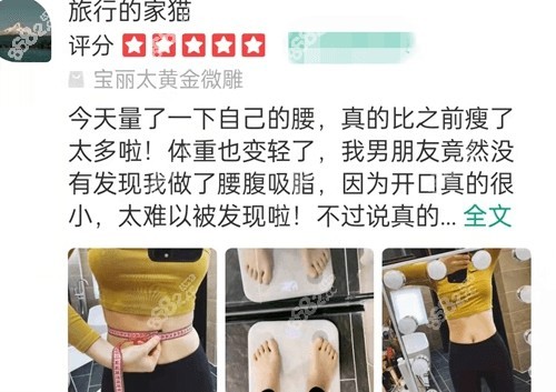 <!--<i data=20240705-sp></i>-->吸脂手术口碑怎么样？