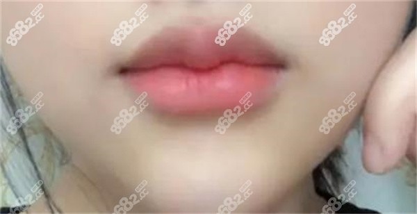 嘟嘟唇图片