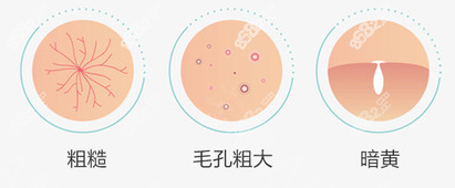 不同的肌肤问题影响顾客在<!--<i data=20240705-sp></i>-->做光子嫩肤的价格