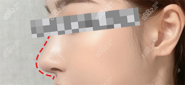 适用人群与禁忌人群