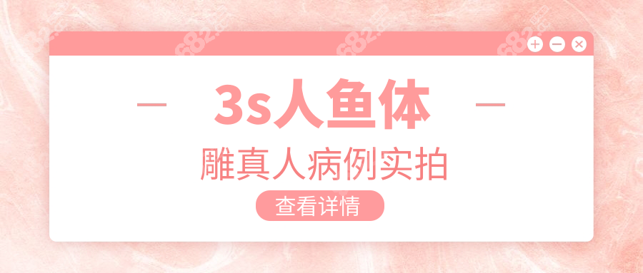 3s人鱼体雕真人病例实拍