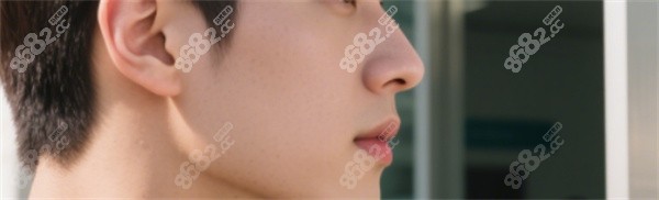 盘点那些 “吸睛” 鼻型，鹰钩鼻适合怎么改？