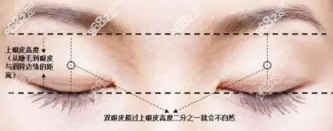杭州张霞飞双眼皮优势
