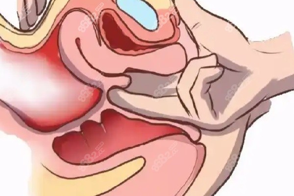 選擇打緊縮針醫(yī)院前的注意事項