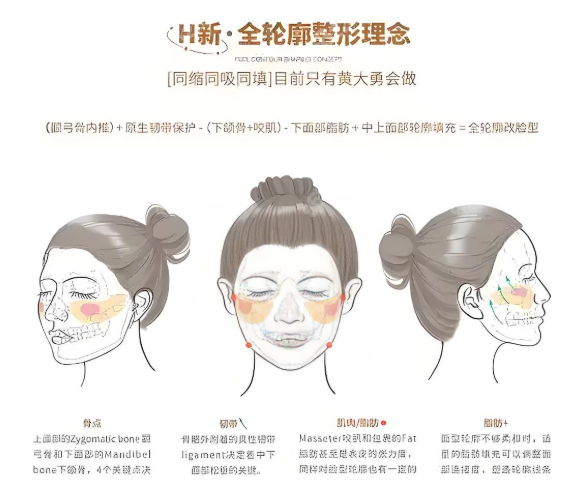 轮廓固定解析 轮廓固定解析