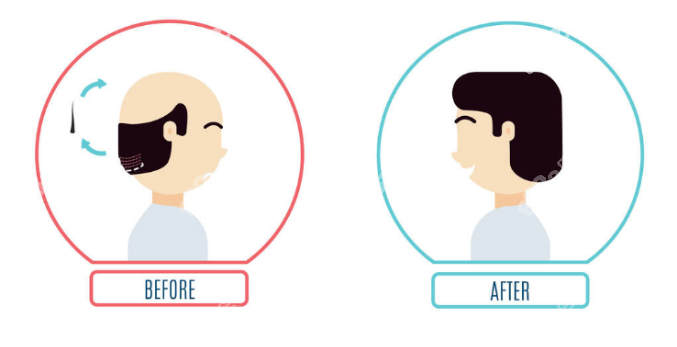 六安植發(fā)好醫(yī)院都有誰