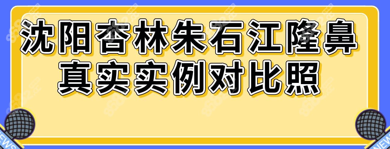 沈阳杏林朱石江隆鼻真实实例对比照