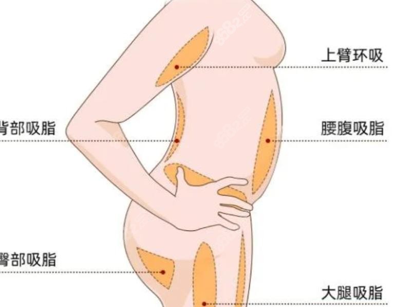全网扒遍万晓楠吸脂帖子