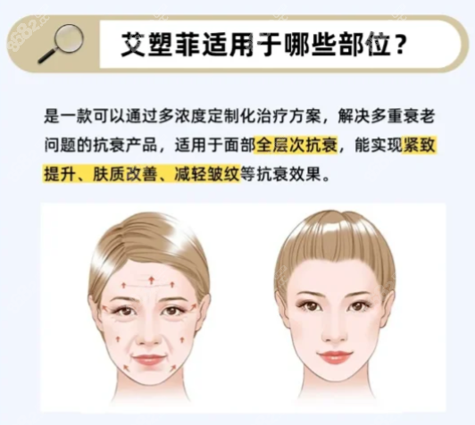 艾塑菲童颜针怎么样