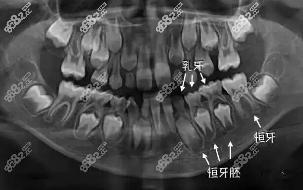 儿牙