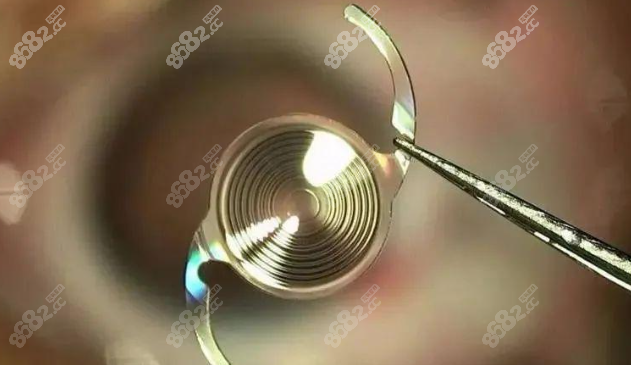 广州中山眼科中心晶体植入预约挂号方式
