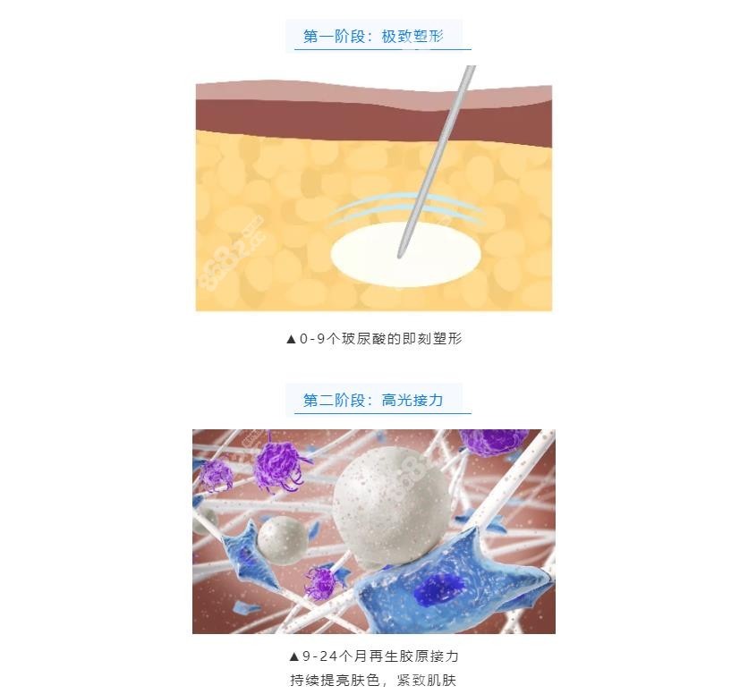 濡白天使针再生过程