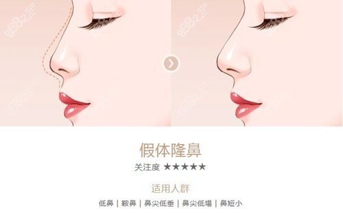 京沃尔刘彦军鼻整形口碑好不好