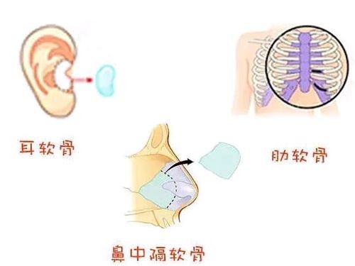 京沃尔刘彦军鼻整形技术好