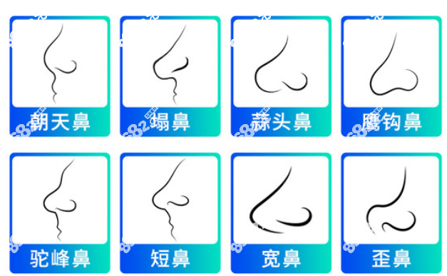 佛山华美可以改善的鼻型8682.cc