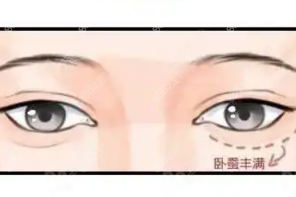 北京雙眼皮醫(yī)院排名第4：北京悅秀醫(yī)療美容門診部