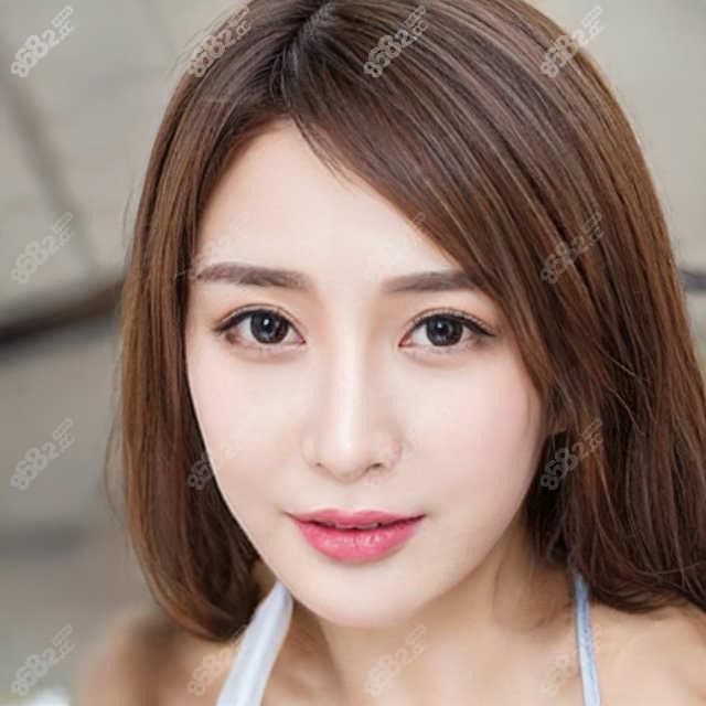 菏泽玻尿酸丰唇多少钱?2024较新价目表+本地靠谱医院真实分享