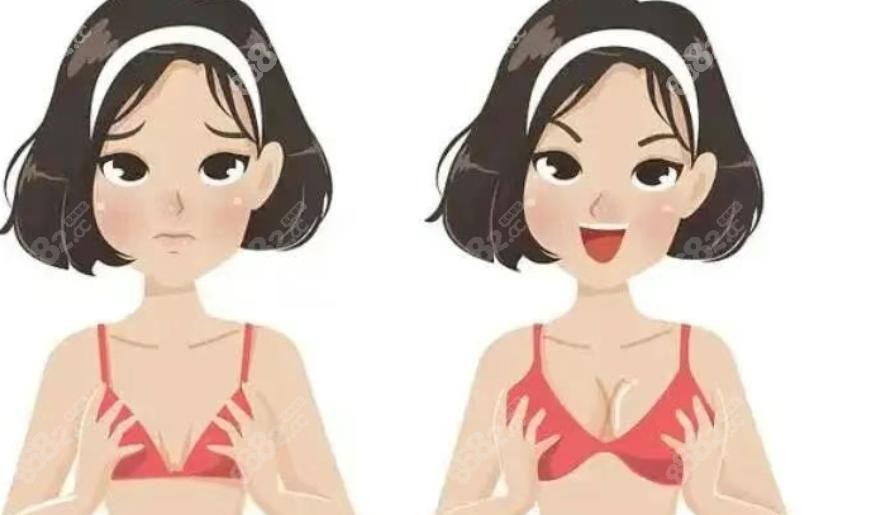 2025美波婷胶原丰胸价格表