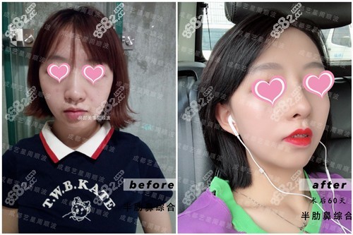 周顺波做鼻子效果
