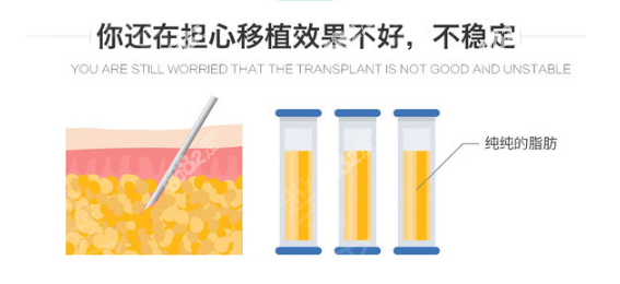 孙泽芳脂肪填充效果好，稳定持久