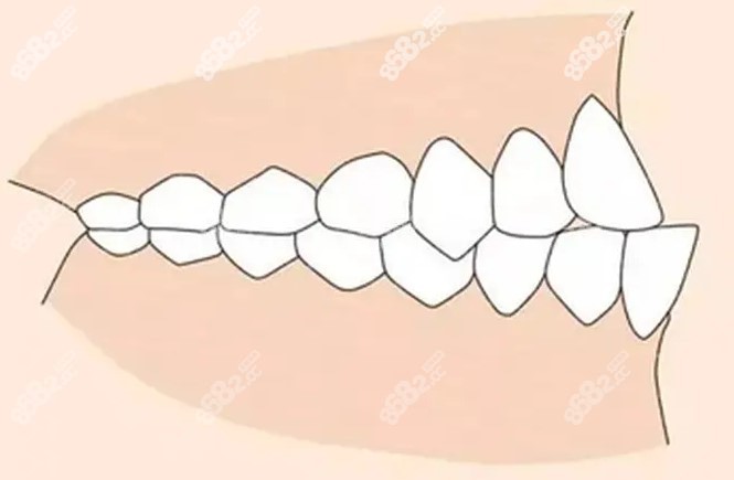 蕪湖美臣口腔矯正價(jià)格貴嗎