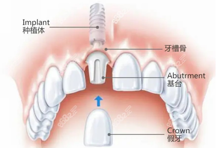 蕪湖美臣口腔收費(fèi)價(jià)目表m.66ub.cn