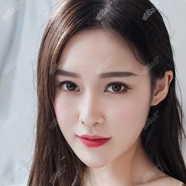 北京加减美黄寅守做面部提升怎样?V美减龄提升技术好口碑赞