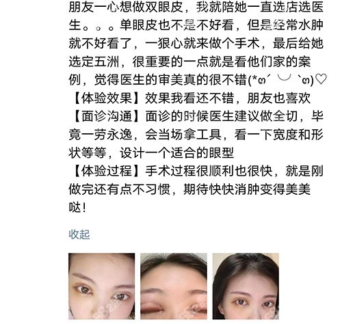 武漢五洲整形醫(yī)院做雙眼皮評(píng)價(jià)