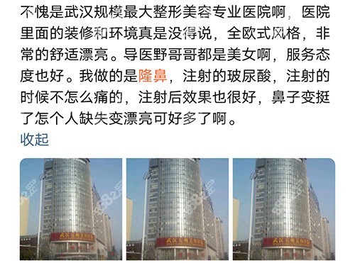 武漢五洲整形醫(yī)院隆鼻評(píng)價(jià)