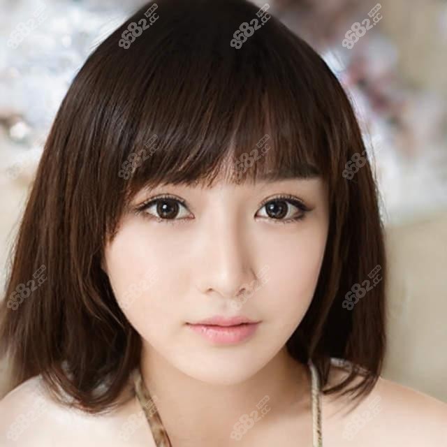 唐红伟鼻子做的好吗 距本地人反馈隆鼻自然高挺成效绝绝子