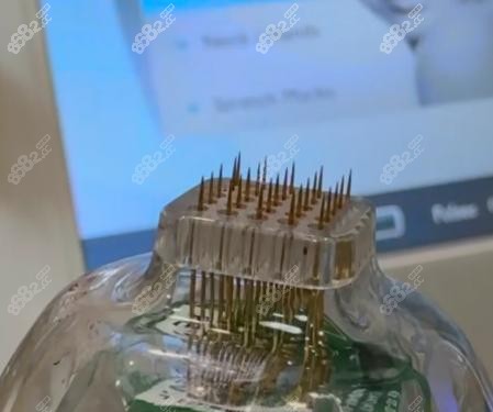 杭州黄金微针多少钱一次