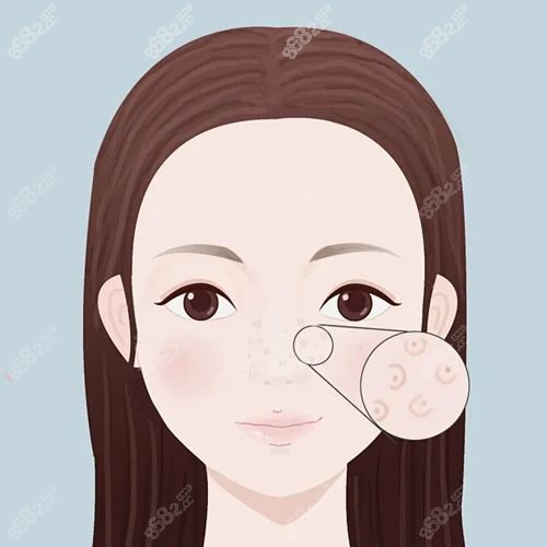 全脸第五代半岛黄金微针真实成效显著