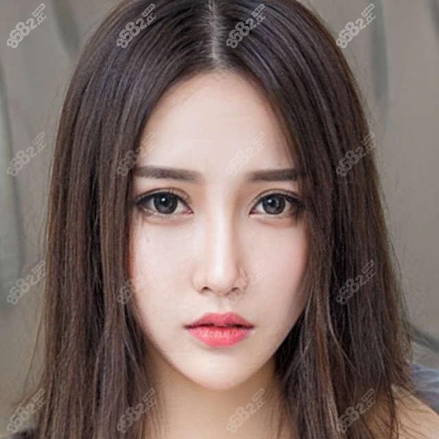 我找广州海峡谭新东取面部奥美定成功,一次取干净确实可靠!