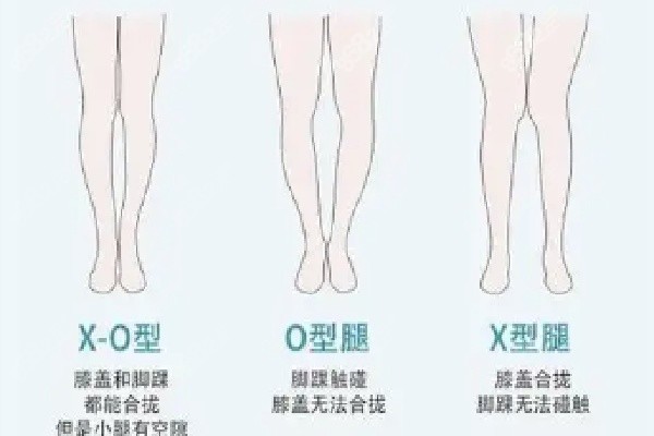 十堰亞美達吸脂塑形行服務怎么樣 十堰亞美達吸脂塑形行服務怎么樣