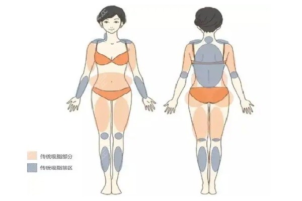 十堰亞美達吸脂塑形價格怎么樣 十堰亞美達吸脂塑形價格怎么樣