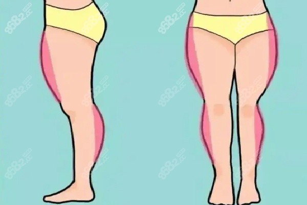 十堰亞美達吸脂塑形技術怎么樣 十堰亞美達吸脂塑形技術怎么樣