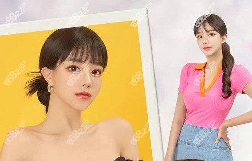 韩国珠儿丽整形外科鼻部整形