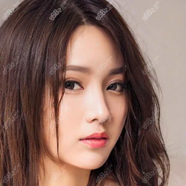 都说不开刀降颧骨不靠谱，了解下北京艺美王东一针降颧骨