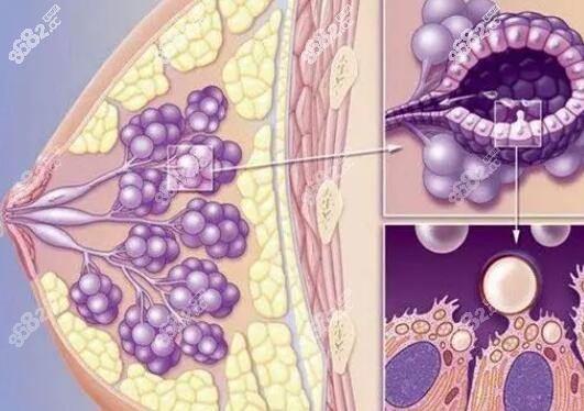 患有乳腺增生和结节的人能做自体脂肪丰胸吗？